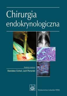 Chomikuj, ebook online Chirurgia endokrynologiczna. Stanisław Cichoń