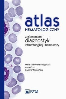 Ebook Atlas hematologiczny z elementami diagnostyki laboratoryjnej i hemostazy pdf