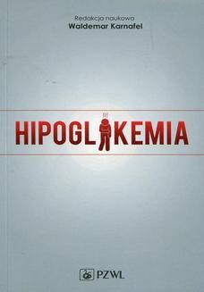 Chomikuj, ebook online Hipoglikemia. Waldemar Karnafel