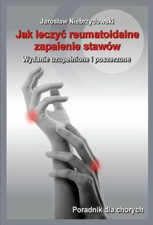 Chomikuj, ebook online Jak leczyć reumatoidalne zapalenie stawów II. Jarosław Niebrzydowski