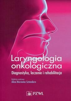 Ebook Laryngologia onkologiczna pdf