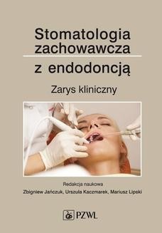 Chomikuj, ebook online Stomatologia zachowawcza z endodoncją. Zbigniew Jańczuk